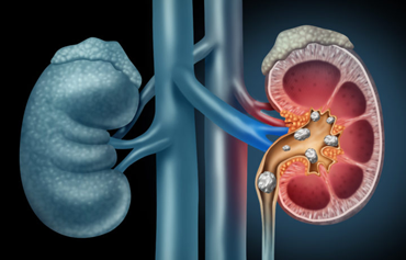 kidney-small